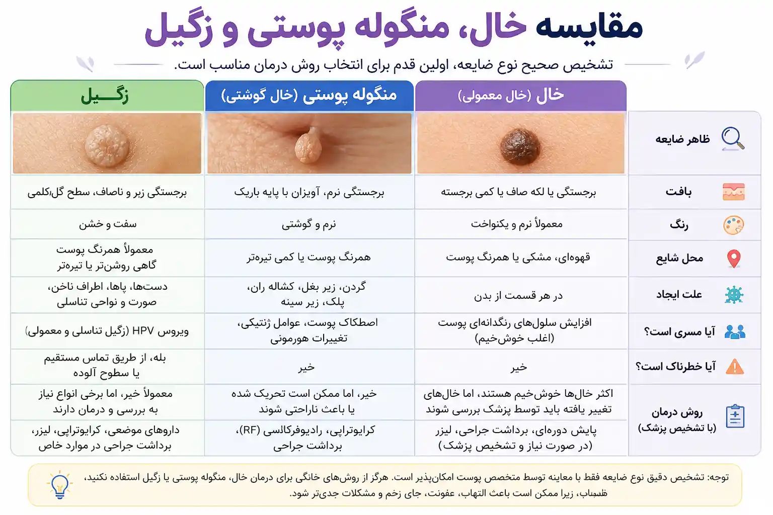 مقایسه خال و منگوله پوستی و زگیل